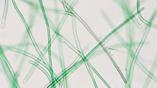 Cyanobacteria. Source: Journey to the Microcosmos