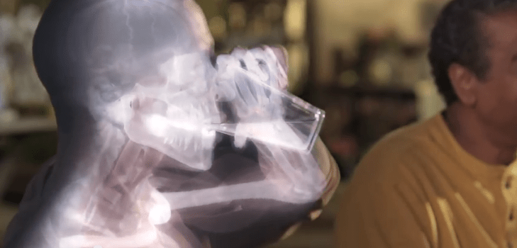 X-rays travel through soft materials but are stopped by denser materials like bone, which lets us image them.